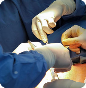 Close-up de mãos cirúrgicas em procedimento para tratamento de doenças benignas digestivas.